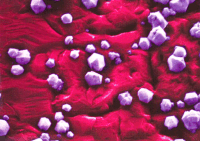 Diamond nucleating on Ni
