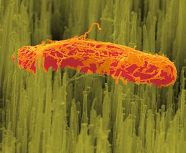 Nanostructured Diamond for Antimicrobial Surfaces