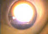 100% CH4 plasma