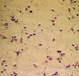 Neurons on Diamond